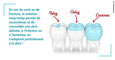 https://docteur-sabine-teiten.chirurgiens-dentistes.fr/L'INLAY ou l'ONLAY