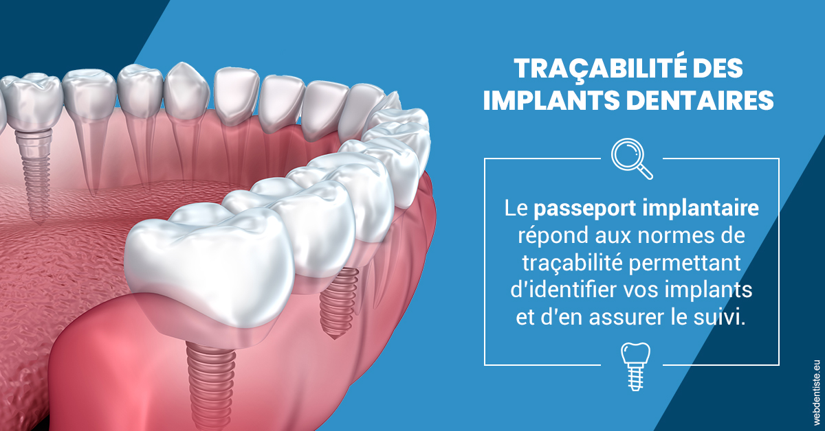 https://docteur-sabine-teiten.chirurgiens-dentistes.fr/T2 2023 - Traçabilité des implants 1