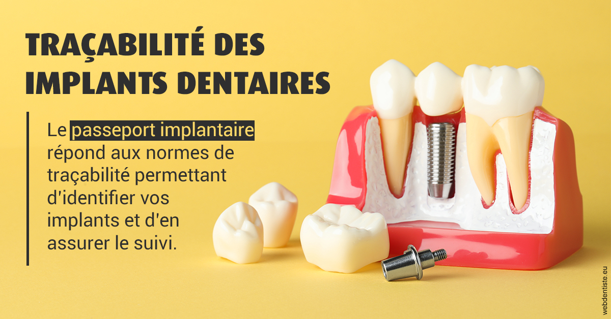 https://docteur-sabine-teiten.chirurgiens-dentistes.fr/T2 2023 - Traçabilité des implants 2