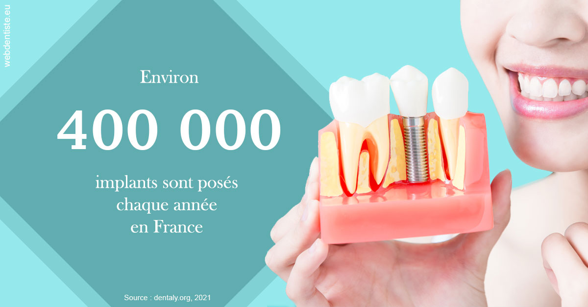 https://docteur-sabine-teiten.chirurgiens-dentistes.fr/Pose d'implants en France 2